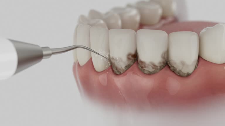 Trusted Teeth Cleaning And Checkup service in Woodland Park, NE - Dentist Open Now